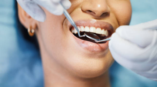 Best Emergency Cosmetic Dentistry in Savannah, GA